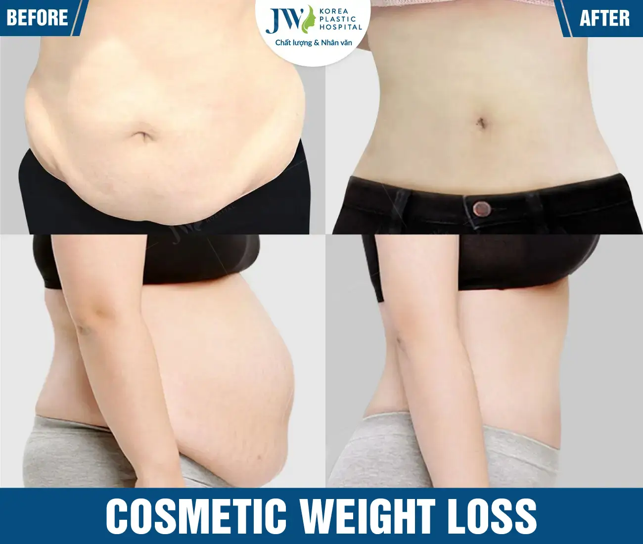 Cosmetic weight loss